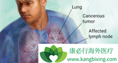 TMB��Ϊ���˵������־���ѱ�д���°�ķ�Сϸ���ΰ�ָ����