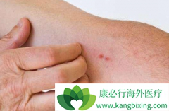 ��΢���޿�������Ƥ����δ�������ʣ�