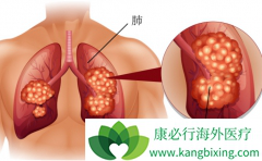 ��������(Alunbrig)�Կ������������ٽ�չ���ߵ���Ч��