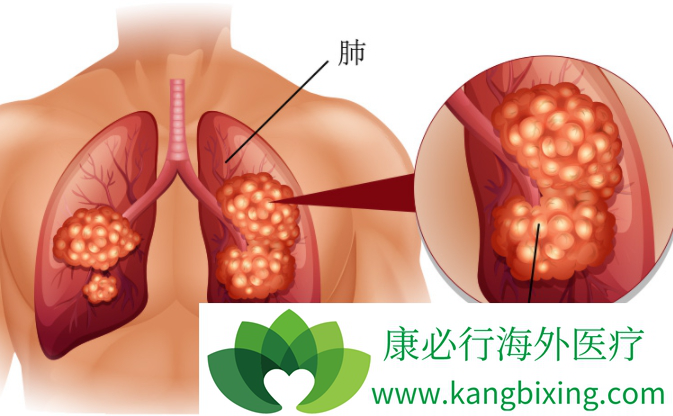 布吉他滨 布吉他滨