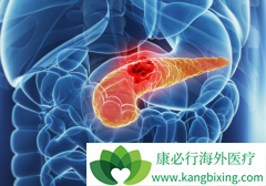 �������������ٰ�����ʧ�ܺ�����ô���ƣ�