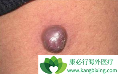 ���߼������Ƽ��Կ���������Ч����ô����