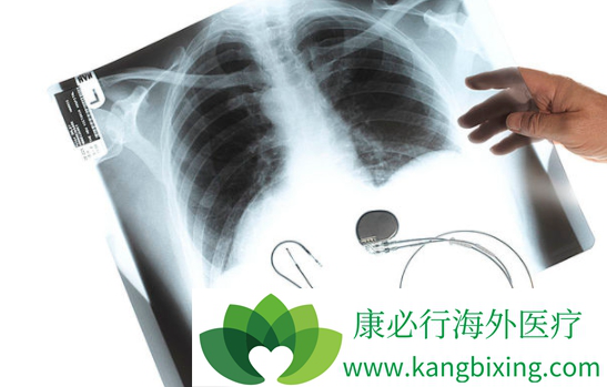 安罗替尼 安罗替尼