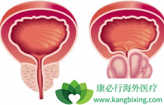 ��е����Ƽ���������(Cometriq)������ǰ���ٰ���