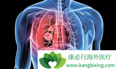 ��������(Alunbrig)�Էΰ���ת�ƻ��ߵ���Ч��ô����