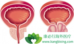 δ�������������Ƶ���֢״��ת����ǰ���ٰ���ô���ƣ�