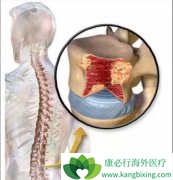 ���˶෢�Թ�����֮��Ի�����������ЩΣ����