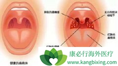 �����尩�Ĳ������������Щ֢״��