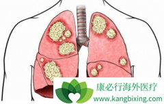 ��������(brigatinib)�Գ������ڷΰ����ߵ���Чզ����