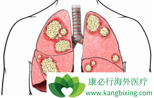 布加替尼 布加替尼