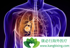 ��������(Brigatinib)����Щ����ȿ����������㣿