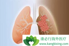 ��ͬʱ�ڷΰ���ת�Ƶ�֢״���ֶ�����Щ��