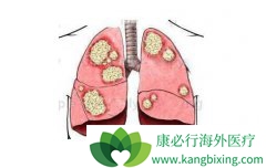 �ΰ����Ƹ����õ���Ҫ�������ļ��㣿