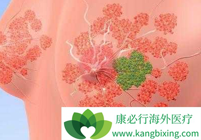 奥拉帕利 奥拉帕利