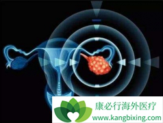 �����е�PARP���Ƽ���������ʵ��������