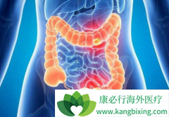 ���ᵥ��(Panitumumab)������Ч������Щ����Ӱ�죿