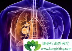 ��Щ��Сϸ���ΰ������ǰ�������Ľ�����Ⱥ��