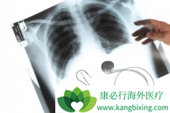 �������������ڼ���Ҫ�����ر��ע�Ĳ�����Ӧ����Щ��