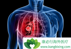 ��������ҩ��ALK�������ŵķ�Сϸ���ΰ�������ô���ƣ�