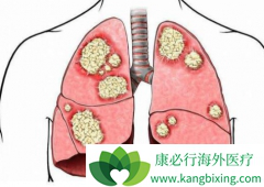 �ΰ���ת�Ʒ����Ƕ෢�Էΰ���ת�������Ҫ�����ֶ�