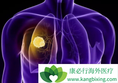 ��ƥ����(ipilimumab)������ɼ���ܸ��Ʒ��۰����ߵ�������