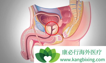 多西他赛 多西他赛