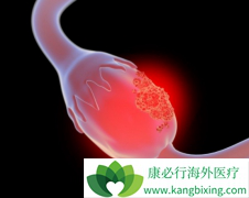 ����������������ᶼ���ӳ��ѳ����ٴο�ʼ������ʱ��