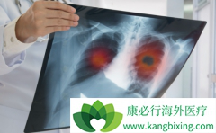 ��������(Brigatinib)�Ƿ�����ӳ�ȫ�Է���ʱ�䣿