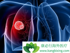 RET�������ŵķΰ�����Ҳ���ÿ�������(Cabozantinib)����