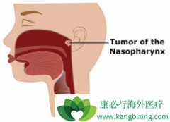 ����������(erbitux)�ܷ����ͷ�����۰�������Ч����