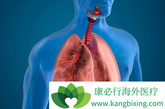 肺癌脑转移 肺癌脑转移