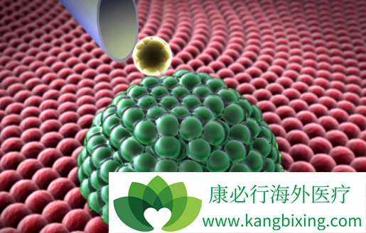 靶向治疗 靶向治疗