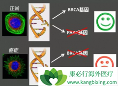 ��������(Niraparib)Ϊʲô��BRCAͻ�䰩ϸ���ر���Ч��