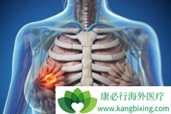 �����鵥��(Perjeta)�����������ٰ����ߵ������ڴﵽ56.5����