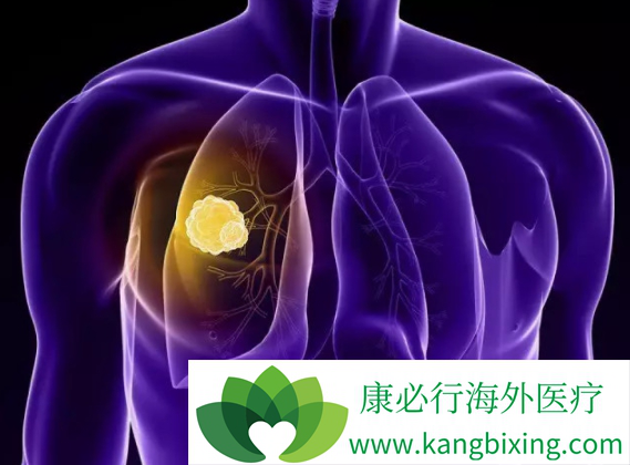 布加替尼 布加替尼