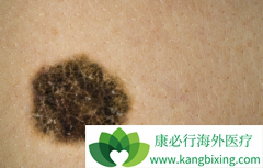 ��ɫ�ذ���ô���ƣ��������������ƺ�ɫ�ذ���