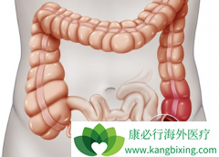 �����������Խ�ֱ��������Ч���ڱ����鵥��