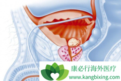 ������ǰ���ٰ�����ѡ����������ʹ������������