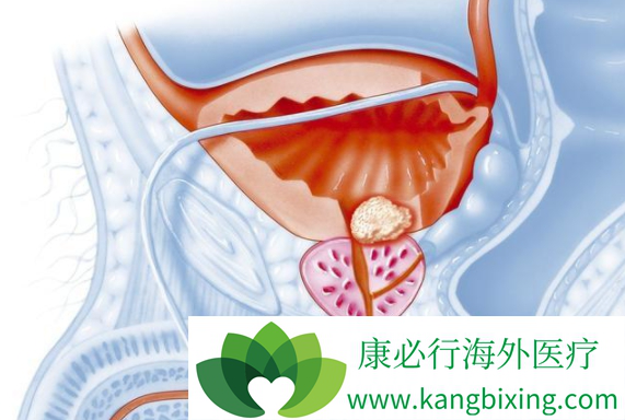 ǰ���ٰ�����