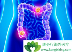 �����鵥��/̩����һ�����ƽ�ֱ������Ч�߸�����С