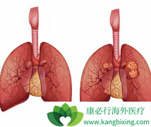 Ŀǰ��������Էΰ�egfr�е�İ���ҩ������Щ��