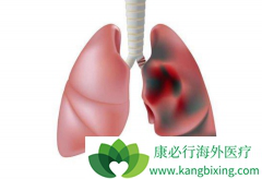 ʲô�Ƿ����۰���EGFR���Ƽ��������Ʒ����۰���