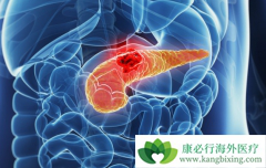 �����������������ٰ����Ƶı�׼���Ʒ�����