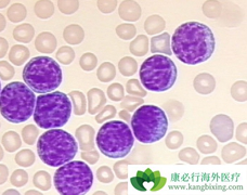 ��Щ����ҩ��������������(rituximab)��������CLL��