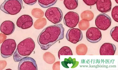 ���������쳣�ۺ�֢��ƶѪΪ��Ҫ�ٴ�����