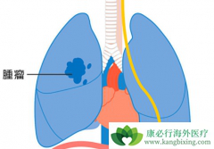 ��������������Ϊ��������Сϸ���ΰ�����Ч��Ѫ�ܰ���ҩ