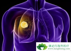 �ΰ����ڻᷢ����Щת�ƣ��ΰ���ת�ƻ�����ߴ�����Щ���⣿