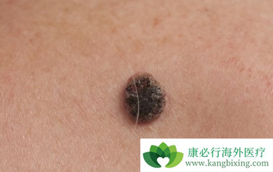 ��ɫ������ʲô