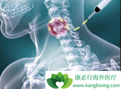 �����ܰͰ��ܻ��ã��ܰͰ��ķ���������Щ������أ�