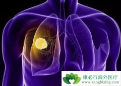 ��Ī«����(Cyramza)��Ӧ֢������ֱ�����ͷΰ���